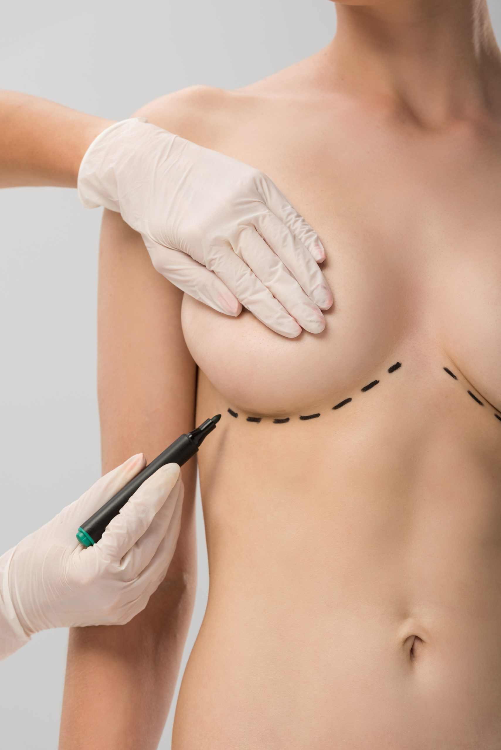 cropped view of plastic surgeon in latex gloves making marks on breast isolated on grey