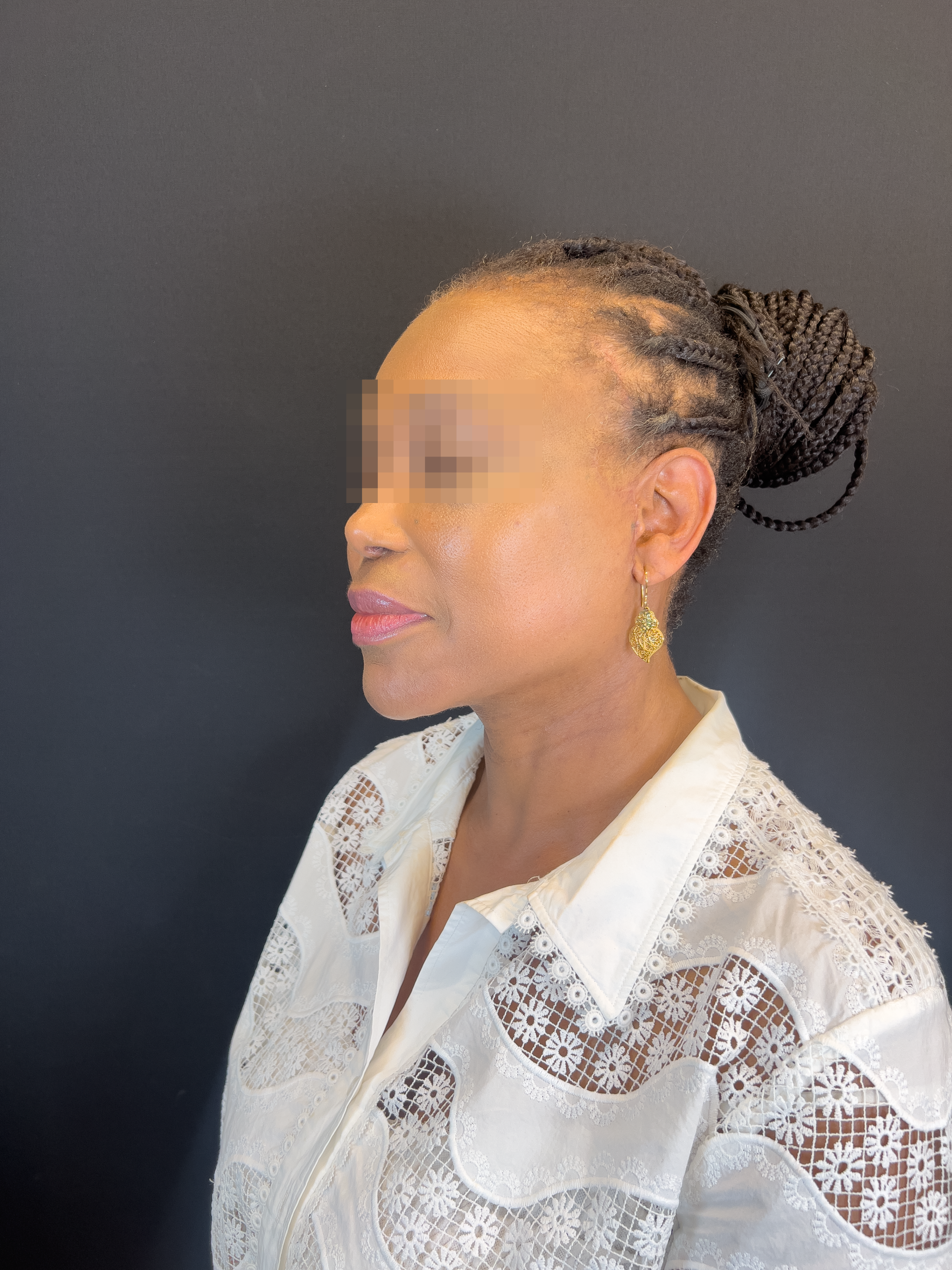 Cicatriz_img_01_blurred